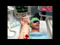 Surgeon simulator #1: The &#39;&#39;dentist&#39;&#39;