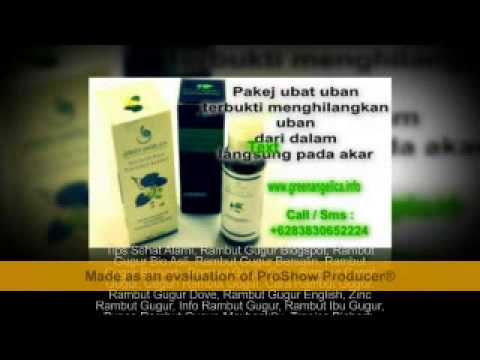 +62838 30 6522 24  Rambut Gugur, Rambut Gugur Bahagian Depan