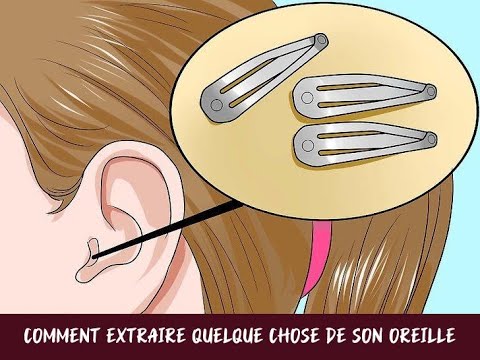 Vidéo: Comment renforcer la vessie et réduire la fréquence des mictions