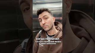 до и после пересадки волос , пересадка волос в передней линии