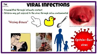 Viral infections | Infectious mononucleosis, Measles, Rubella screenshot 1