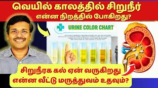 வெயில் காலத்தில் எப்படி கிட்னி கல் உருவாகிறது? என்ன வீட்டு மருத்துவம்? kidney stones treatment?