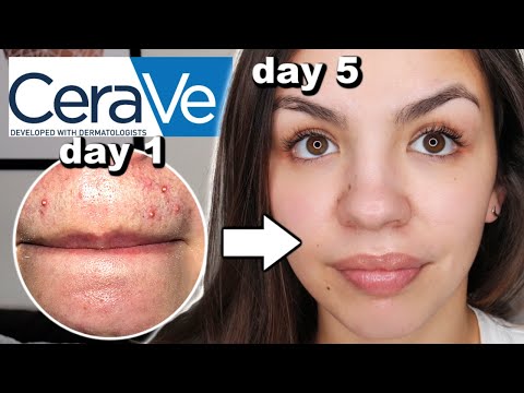 Today we're talking all things MOISTURIZERS! This may or may not be, the most important step in your. 