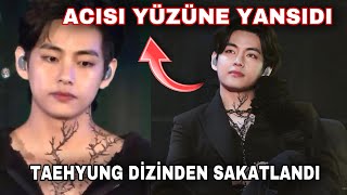 Taehyungun Konserde Acısı Yüzüne Yansıdıarmyler Üzgün