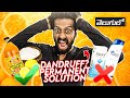 STOP DANDRUFF PERMANENTLY With These TRICKS (7 Natural remedies)