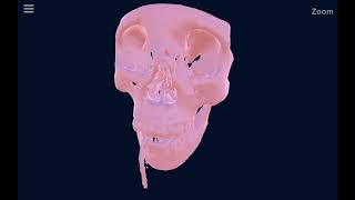 The computed tomography data (scan) viewing in mobile device screenshot 2