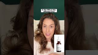 Famous Struggling with stretch marks? Follow this routine #skincare #shortsvideo #skincaretips Profile