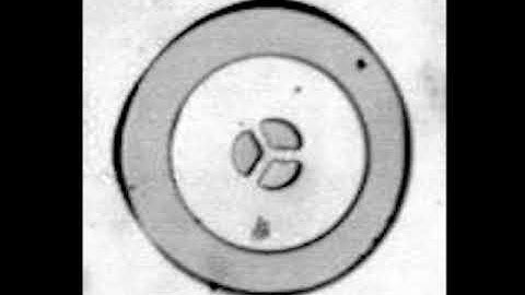 3-ring BZ inhibitory coupled oscillator network