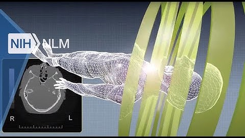Computerized Tomography CT