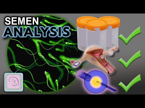 Abnormal semen analysis? 3 options to help you conceive