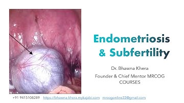 Endometriosis & Subfertility TOG MRCOG Part 2 Exam /Must do for MRCOG Exam July 2024/ Bhawna Khera