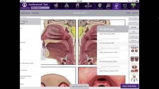 ICD-10 Ready: EHR System for Otolaryngologists