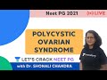 Polycystic Ovarian Syndrome | NEET PG 2021 | Dr. Shonali Chandra
