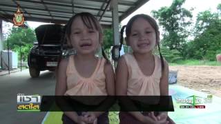 ขอนแก่น เด็กแฝดกตัญญู | 120759 | เช้าข่าวชัดโซเชียล | ThairathTV