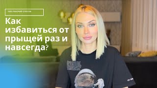 Как избавиться от прыщей и акне? ПРОСТОЙ РАБОЧИЙ СПОСОБ