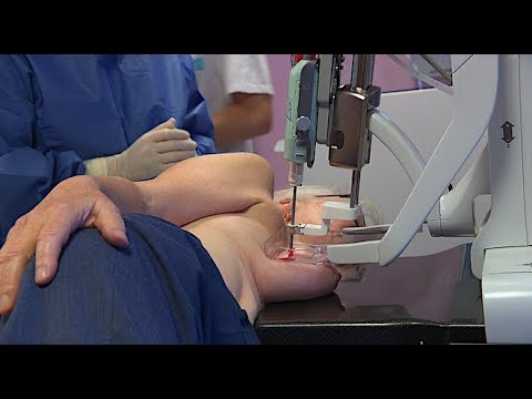 Vidéo: Caractérisation Des Cellules épithéliales Du Cancer Du Sein Humain (HBCEC) Dérivées De Biopsies De Culture à Long Terme