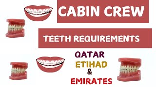 Dentures, Braces & Retainers Allowed - Cabin Crew Candidates