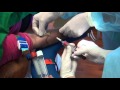 How to use contemporary biological enhancers(bone graft),phlebotomy.