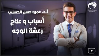 أسباب و علاج رعشه الوجه-أ.د.عمرو حسن الحسني أستاذ المخ والأعصاب