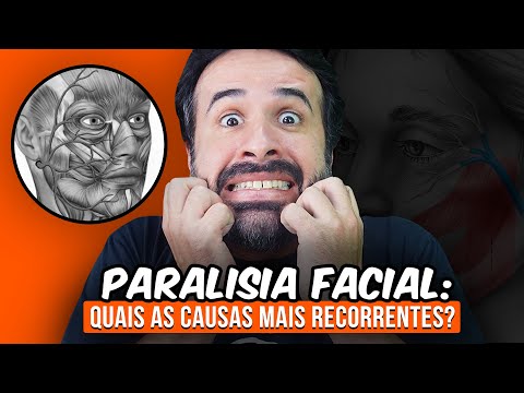 QUAIS AS CAUSAS MAIS RECORRENTES DA PARALISIA FACIAL