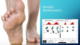 Dolor en el talón. Fascitis plantar