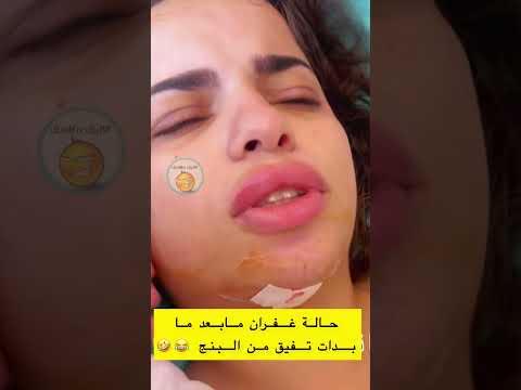 حالة غفران من بعد ما بدات تفيق من البنج لاتنسوا الاشتراك في القناة