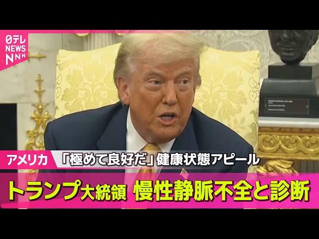 【アメリカ】トランプ大統領、慢性静脈不全と診断される…健康状態は良好/関税交渉どうなる？“キーマン”ベッセント財務長官来日、18日に石破首相と会談へ──国際ニュースライブ （日テレNEWS LIVE）