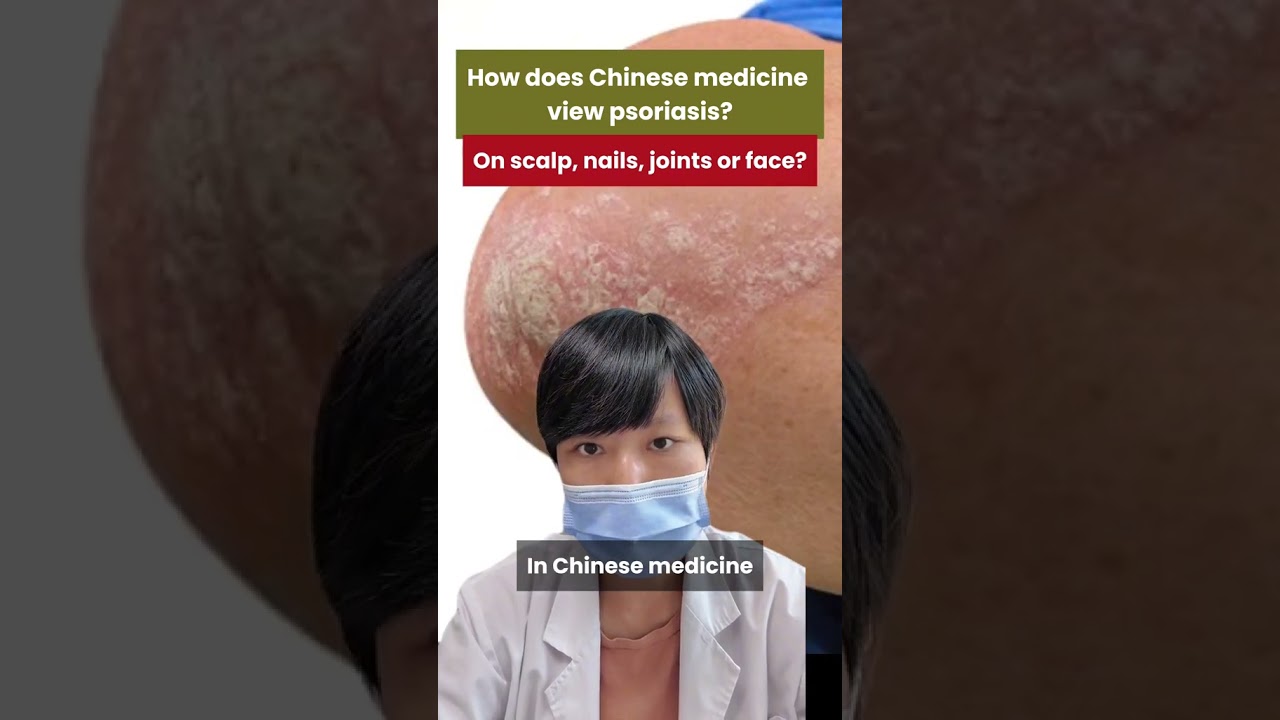 Псориаз или просто сухость кожи? | ТКМ объясняет первопричину | GinSen London