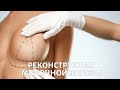 Реконструкция молочной железы: мастэктомия не приговор?