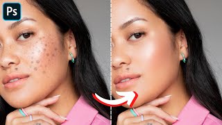 Skin Retouching - Photoshop tutorial | Skin Retouching in Photoshop- - Pixel Perfect