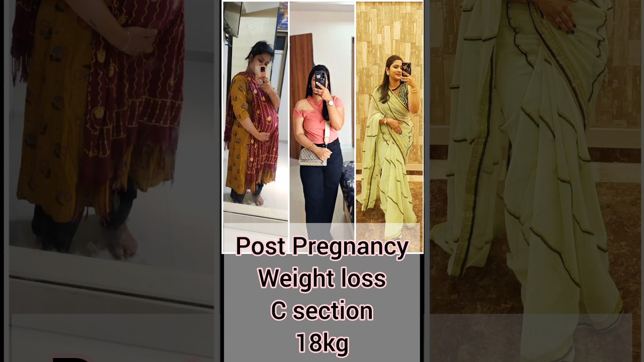 Weight loss after C-section,Subscribe for more such videos 
