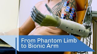 From Phantom Limb to Bionic Arm | CNRS in English