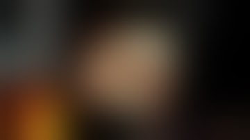 Case 5_ERCP and SpyGlass cholangioscopy for biliary stricture