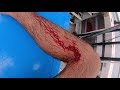 SPEARFISHING ACCIDENT! Sliced Artery B2B Pacific Tour (Ep:25)