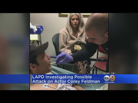 Video: Actor Corey Feldman Was Stabbed In Los Angeles