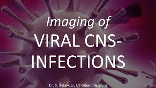 Imaging of viral Encephalitis (complete)