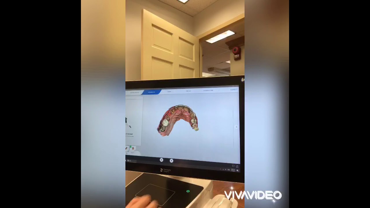 How to make a Cerec bridge inhouse YouTube