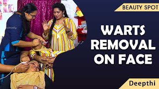 Warts Removal on face Prevention and Treatment Beauty Kaumudy