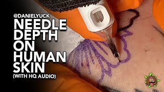 Needle Depth On Human Skin With HQ Audio
