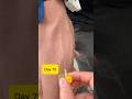 Flawless 24G Yellow IV Insertion Technique! 💉 #Shorts #viralshorts #viral #safai#safi