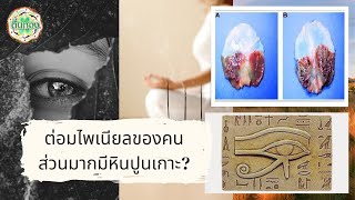 ต่อมไพเนียลในสมองของคุณมีหินปูน | ตื่นทอง