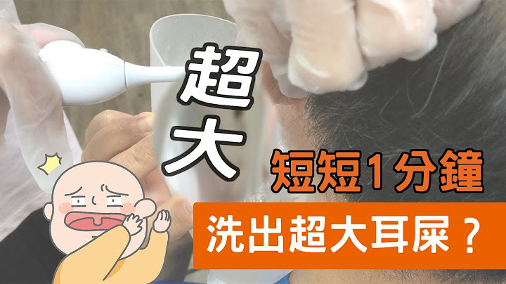 【诊所洗耳患者】短短1分钟竟然清洗出"魔王级"耳屎，惊讶到护士措手不及 - 天天要闻