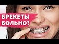 Больно ли ставить брекеты на зубы?