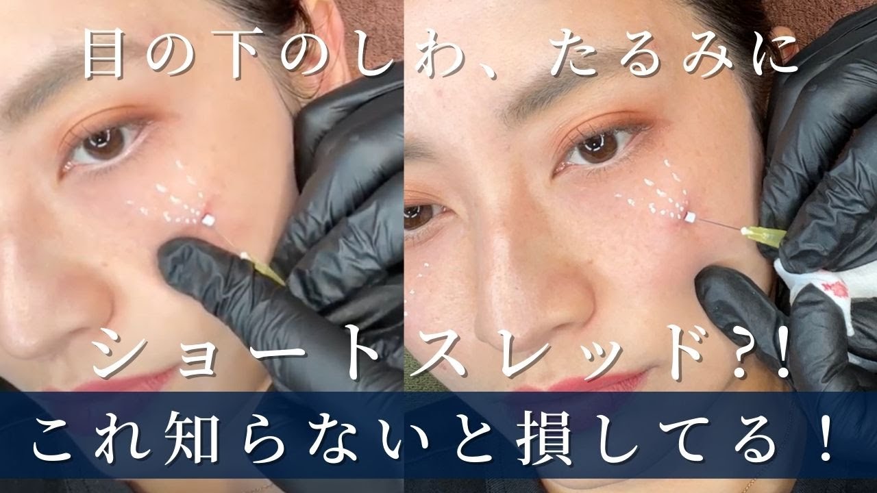 ショートスレッドと目元に？！アイスレッドって知ってる？