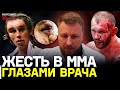 Врач смотрит страшные травмы из ММА / ПЕРЕЛОМ Конора, РАССЕЧЕНИЕ Силвы, ГЕМАТОМА Серроне