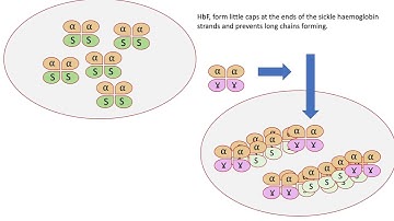 Hydroxycarbamide  how it works in SCD sickle cell disorder