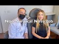 Non surgical rhinoplasty nose job  rivkin aesthetics dr alexander rivkin los angeles ca