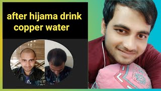 benefit of  copper water/copper m pani pine ke fayde/tambe ke bartan ka pani ke fayde