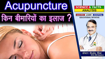 ACUPUNCTURE किन बीमारियों का इलाज ? || ACUPUNCTURE THE MEDICAL FACTS