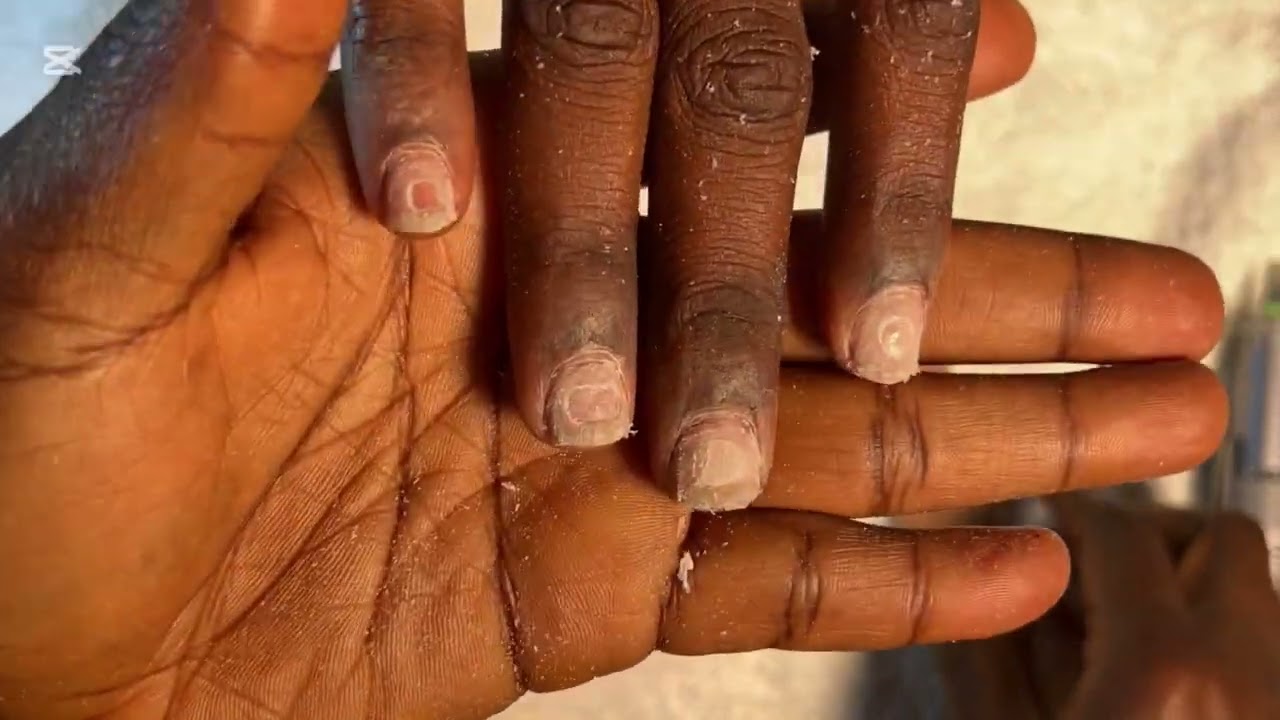 How to Remove Your Nails Properly — Safe & Simple (Press-ons, Gel + Aftercare)